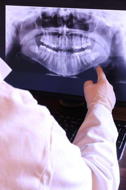 Best Emergency Dentist for Knocked-Out Tooth in Lansing, IL