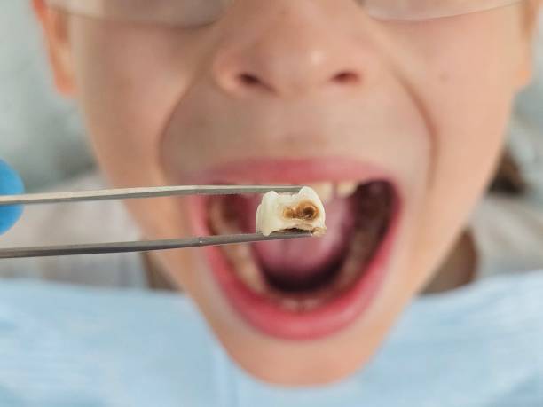Best Emergency Dental Services for Seniors in Lansing, IL